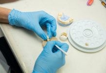 Fast and fixed – proteza fixa si atractiva intr-o singura zi